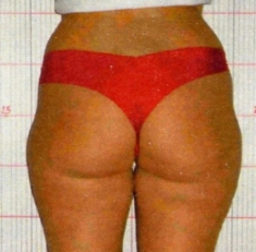 Prima del trattamento